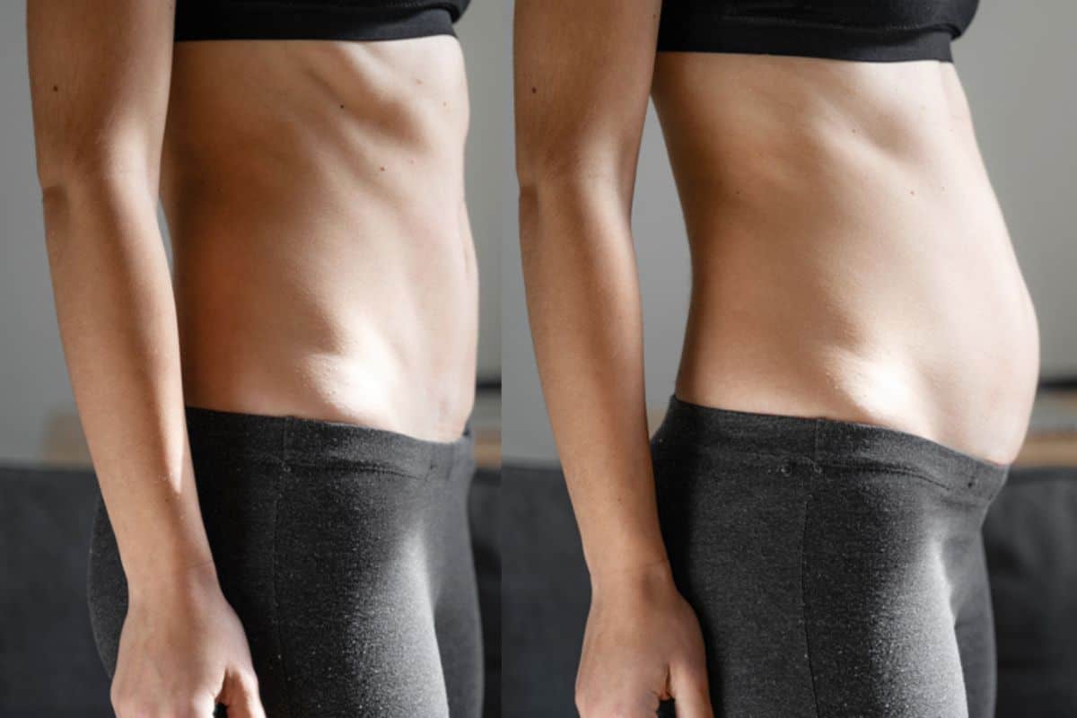 How long does diastasis recti take to improve Edgware?