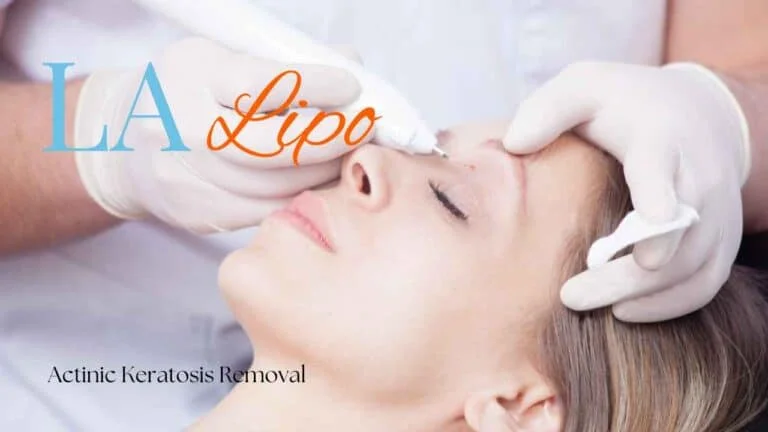 Woman receiving Actinic Keratosis Removal Treatment Edgware