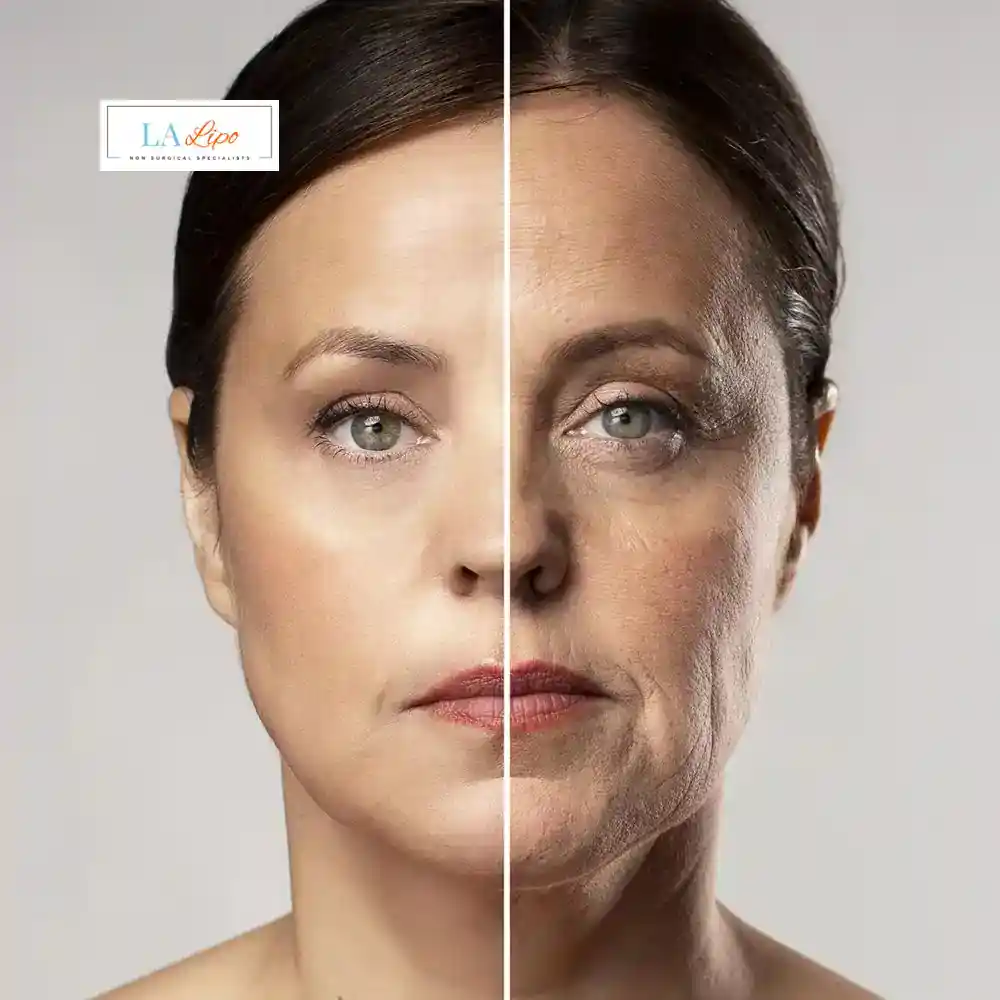 How Can You Tell If Non-Surgical Skin Tightening Is Right for You Edgware?