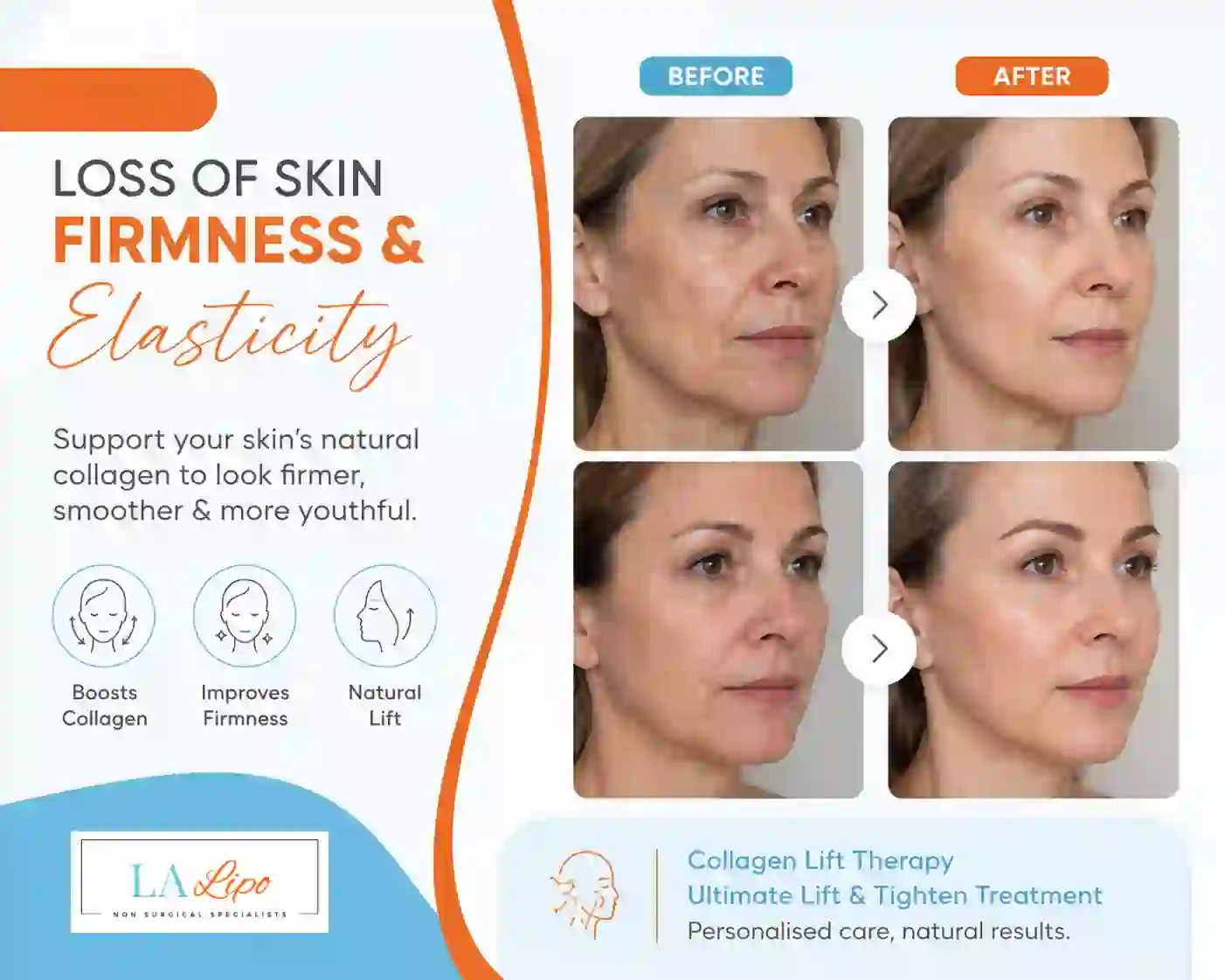 Sign #7: Loss of Skin Firmness and Elasticity Edgware