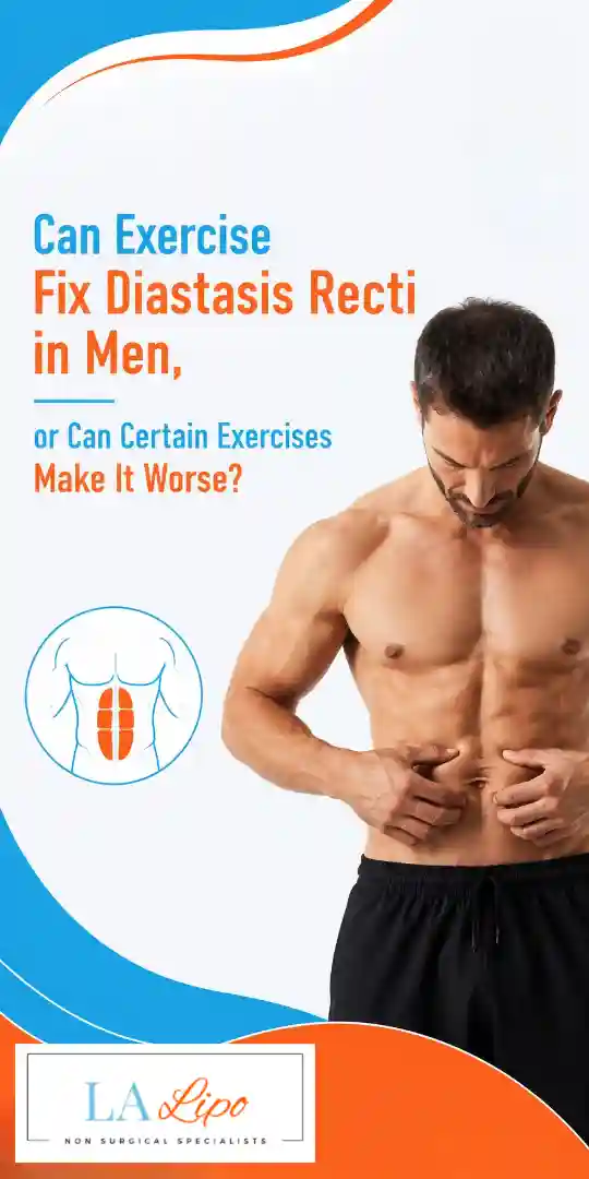 Can Exercise Fix Diastasis Recti in Men, or Can Certain Exercises Make It Worse Edgware?